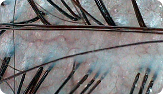 고배율 현미경 진단기