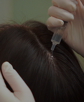 모발성장인자 바이오관리